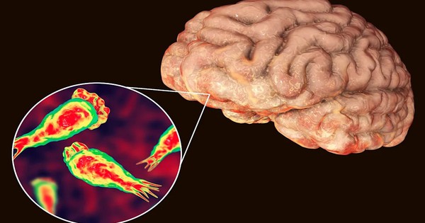Virus JC: 'Sát thủ não' tiềm ẩn trong cơ thể hàng tỷ người có thể thức tỉnh