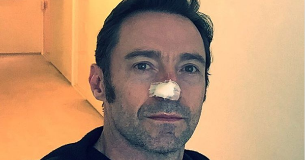 "Người sói" Hugh Jackman và thông điệp gửi đến người hâm mộ trên Instagram  sau khi bị ung thư da