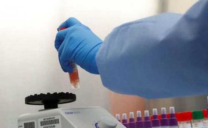 Mỹ áp dụng thử nước bọt để phát hiện virus SARS-CoV-2