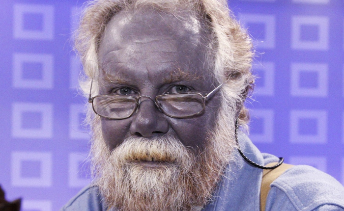 Gia tộc Fugate: "Những người ngoài hành tinh" với làn da xanh bị cô lập với thế giới hàng trăm năm