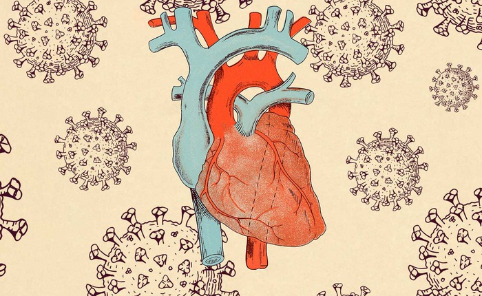 Khoảng 3/4 bệnh nhân COVID-19 có những con virus trong tim mình
