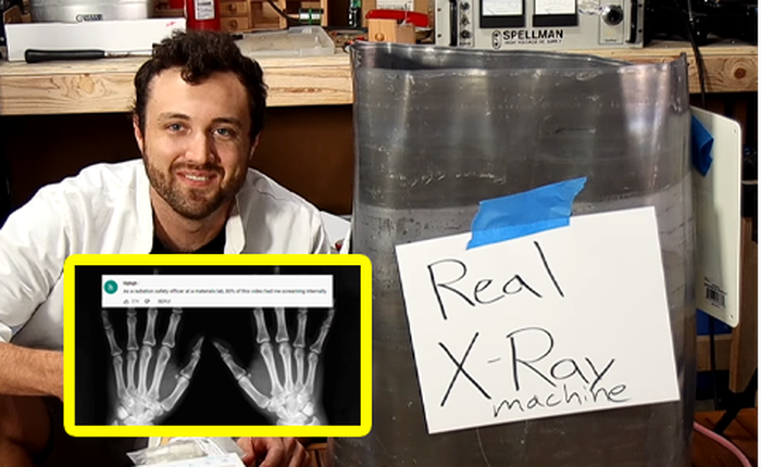Phải đóng gần 1,6 tỷ đồng tiền viện phí, anh chàng bức xúc về nhà đăng lên YouTube tuyên bố tự tay lắp chiếc máy X-quang tại nhà và kết quả bất ngờ