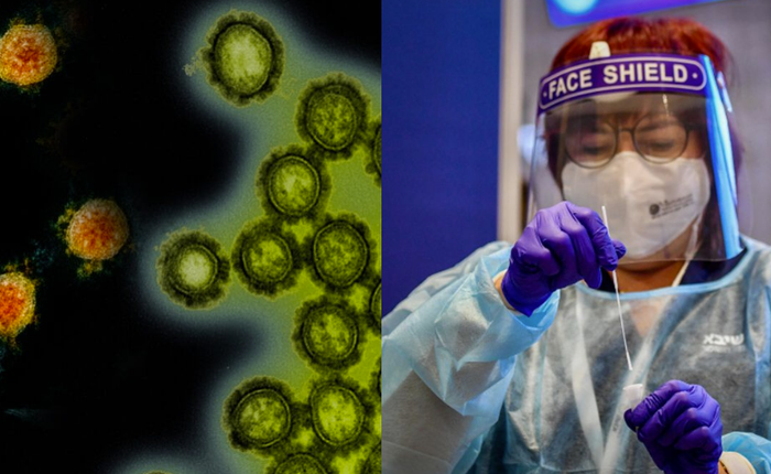 Người đầu tiên nhiễm cúm và COVID cùng lúc: Liệu 2 virus này có khắc chế nhau?