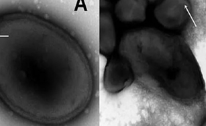 Giới khoa học lo ngại khi virus cổ đại 'hồi sinh' sau gần 50.000 năm chôn vùi dưới băng vĩnh cửu