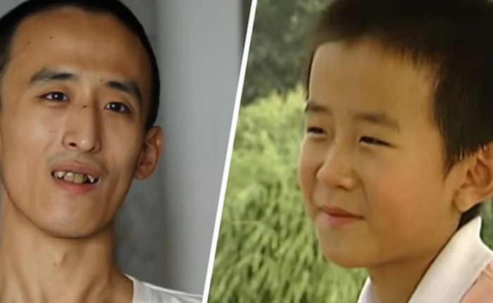 Bi kịch của “thần đồng toán học” Trung Quốc: 16 tuổi học tiến sĩ, 28 tuổi vẫn “ăn bám bố mẹ”