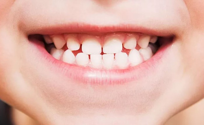 Phát triển loại thuốc giúp răng mọc lại nhiều lần