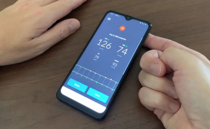 Tất cả ứng dụng đo huyết áp trên điện thoại đều là "trò bịp", chỉ trừ ứng dụng Android này, nhưng tại sao nó chưa có trên iPhone?