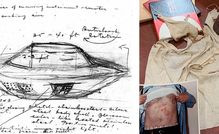 Sự kiện UFO hồ Falcon: Người đàn ông bị bỏng sau khi chạm vào UFO và dấu vết trên cơ thể không mờ đi suốt 32 năm!