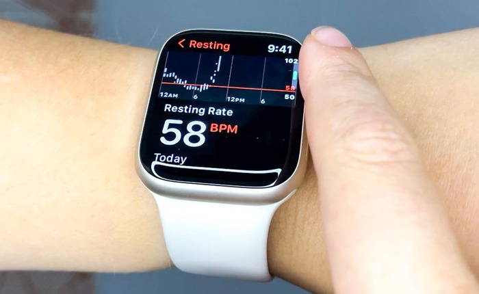 Người dùng Apple Watch sắp được trải nghiệm tính năng mà Samsung trang bị cho Galaxy Watch từ lâu