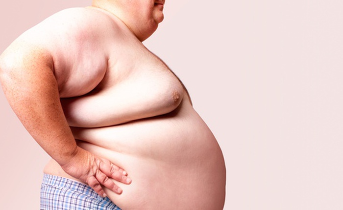 WHO: Thế giới chào đón công dân béo phì thứ 1 tỷ, con số tăng gấp 5 lần kể từ khi thế hệ 9x ra đời