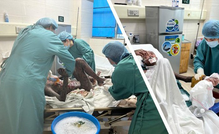 Kỳ tích y khoa: Điều trị ca bệnh hiếm đầu tiên tại Việt Nam, cả thế giới chỉ có 10 ca