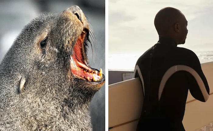 Hải cẩu mắc bệnh dại tấn công người ở Nam Phi: Nỗi ám ảnh mới trên bờ biển Cape Town