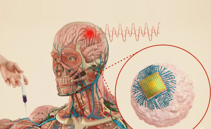 Chip não tiêm của MIT có thể điều trị bệnh mà không cần phẫu thuật
