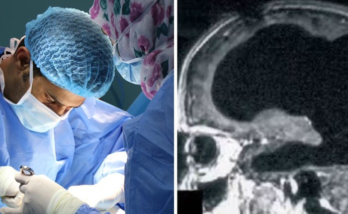 Bí ẩn về người đàn ông mất 90% não, nhưng vẫn có thể sống một cuộc sống bình thường