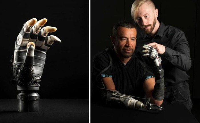 Kỹ sư Mỹ phát triển bàn tay sinh học tích hợp AI giúp người khuyết tật cầm nắm chính xác như tay thật