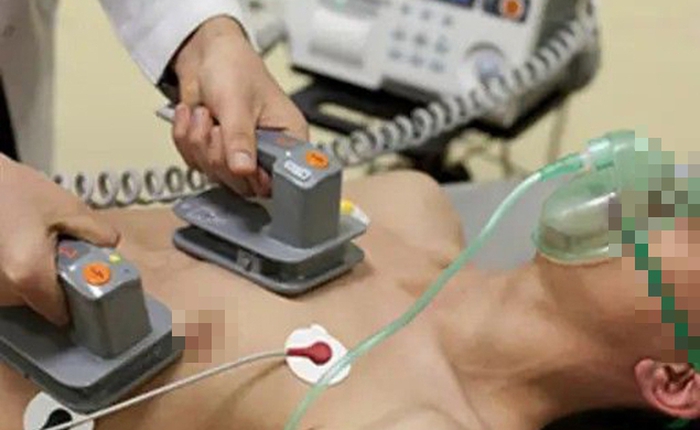 Nam nhân viên IT đột ngột ngừng tim khi đang làm chuyện ấy, người vợ khóc: "Anh ấy vốn khỏe mạnh, vừa tập gym về"