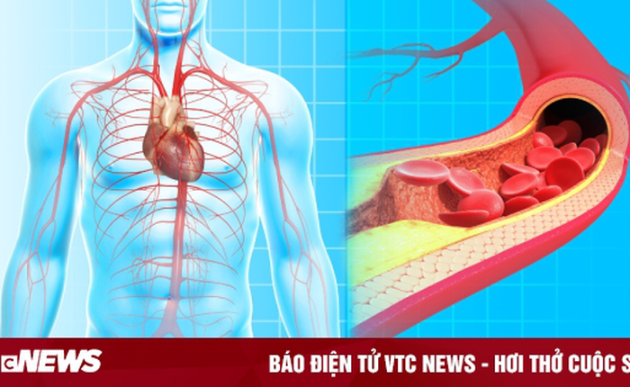 Mạch máu càng trẻ, càng sống lâu: Bác sĩ chỉ cách kiểm tra và làm sạch mạch máu