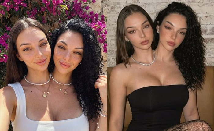 Cú lừa ngoạn mục của kỷ nguyên số: Cặp song sinh dính liền "vạn người mê" này thực chất là sản phẩm của AI