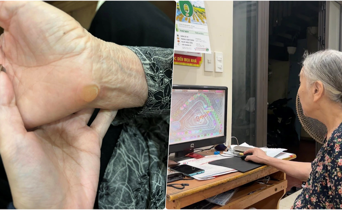 Cụ bà U90 chai cả tay vì "nghiện" game, trò bà chơi chắc chắn 9x đời đầu cảm thấy rất quen