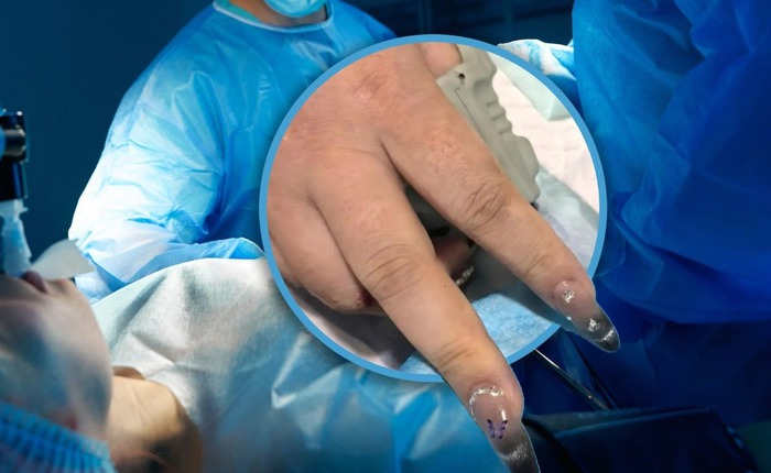 Ca cấp cứu kỳ lạ ở Trung Quốc: Bác sĩ bất lực, bệnh viện buộc gọi thợ làm móng vào phòng cấp cứu gấp