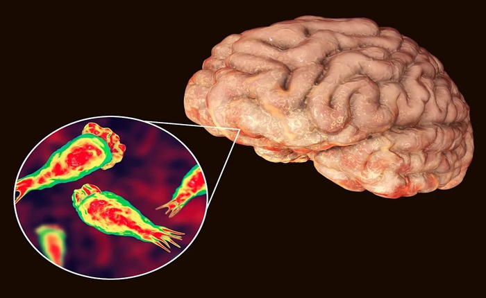 Rất có thể bạn đã bị nhiễm một loại virus ăn não mà bạn chưa từng nghe đến