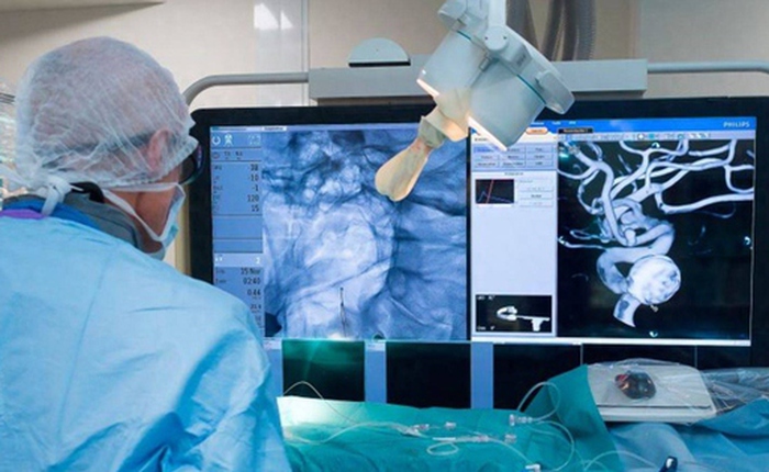 Robot can thiệp mạch máu của Trung Quốc đạt 100% thành công, rút ngắn gần một phần ba thời gian phẫu thuật não