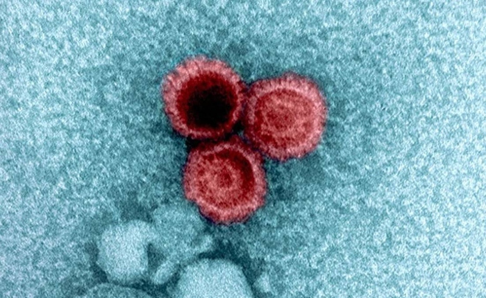 Tại sao một số virus lại tồn tại ở trạng thái ngủ đông trong cơ thể người suốt đời?