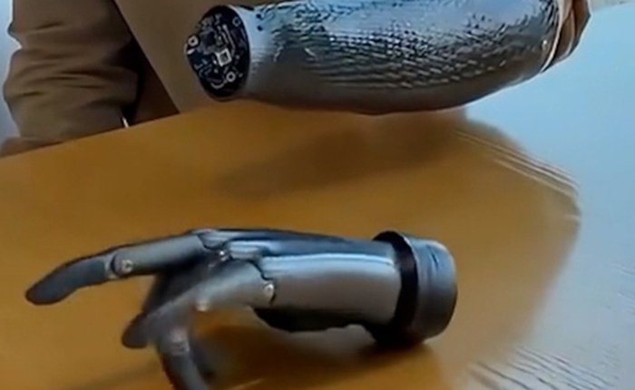Trung Quốc lại một lần nữa khiến cả thế giới bất ngờ với cánh tay giả có thể "đọc" suy nghĩ và di chuyển linh hoạt ngay cả khi không kết nối với cơ thể người!