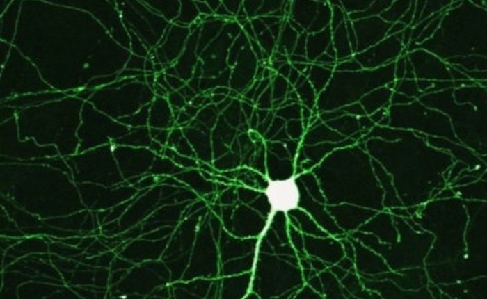 Một lý thuyết đã lỗi thời trong y học về tế bào thần kinh