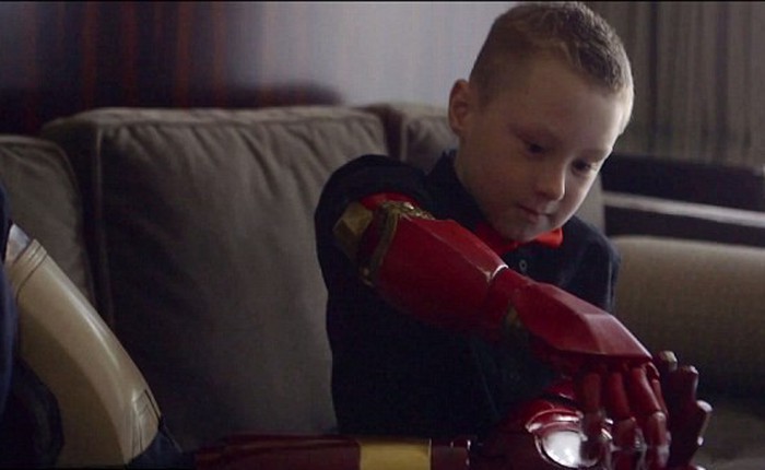 Cánh tay người máy của Iron Man được lắp cho một cậu bé khuyết tật