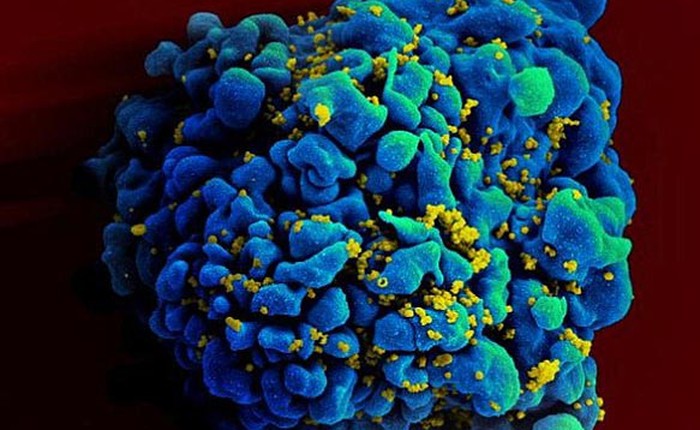 Đã tìm ra vắc-xin phòng HIV?