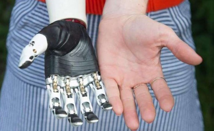 Tay robot cử động uyển chuyển như tay người thật