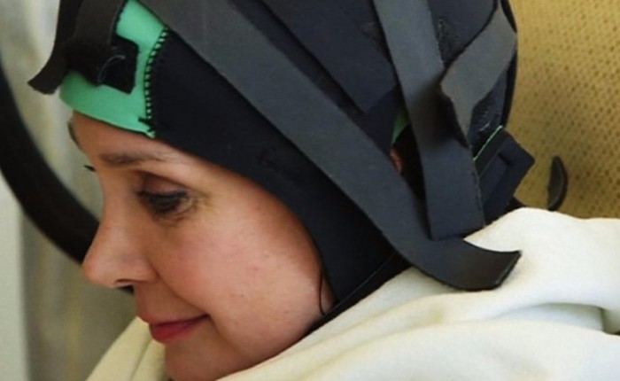 [Video] Đây là chiếc mũ thần kì giúp bệnh nhân đang trong giai đoạn hóa trị không còn hói đầu