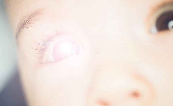 Đèn flash có thể gây mù mắt trẻ sơ sinh hay không? Hãy để chuyên gia giải thích