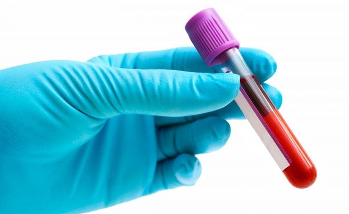 Phát hiện đột phá của y học: chỉ cần xét nghiệm máu cũng phát hiện ung thư