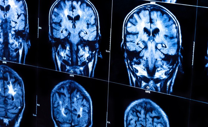 Các nhà khoa học đã có thể "copy" và "paste" lại các ký ức trong não chúng ta