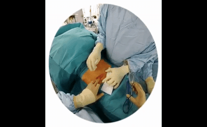 Chứng kiến trực tiếp quá trình phẫu thuật bệnh nhân được ghi lại bởi kính Snapchat từ bác sỹ thực hiện