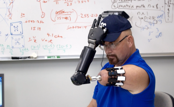 Người đàn ông với cánh tay máy điều khiển bằng trí não này chính là ví dụ về cyborg đời thực
