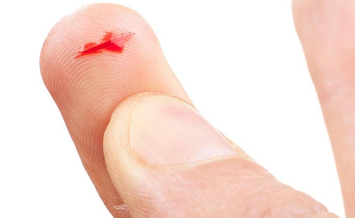 Vì sao vết cắt từ giấy trên đầu ngón tay lại đau đến thế?