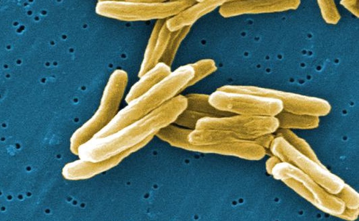 Đây là 10 lý do tại sao bây giờ kháng kháng sinh đã trở thành cơn ác mộng