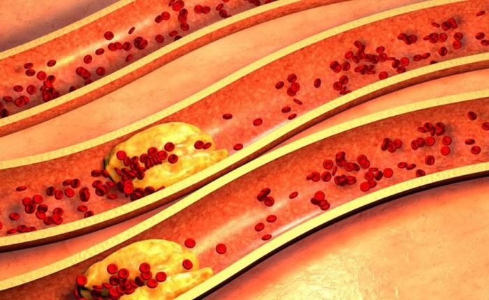 Tại sao cholesterol có loại xấu, loại tốt và bạn nên ăn uống như thế nào?