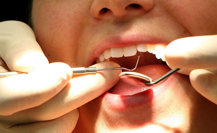 Tìm ra loại thuốc kích thích răng tự hồi phục, không cần tới hàn răng nữa