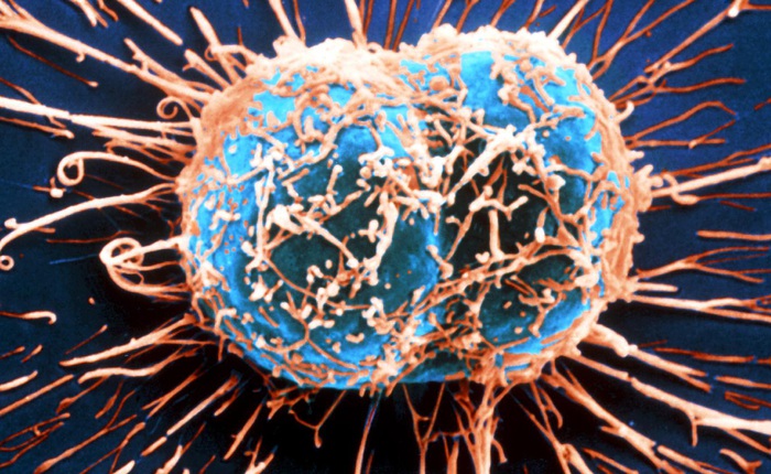 Tế bào ung thư rất "láu cá", chúng giả vờ nhiễm virus để tự mạnh lên và kháng thuốc điều trị