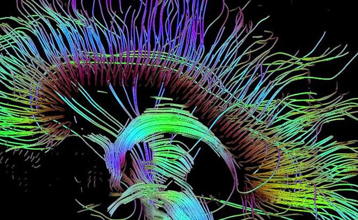 Hình ảnh quét não bộ cho thấy óc sáng tạo được cài đặt sẵn trong chúng ta như một đặc điểm sinh học