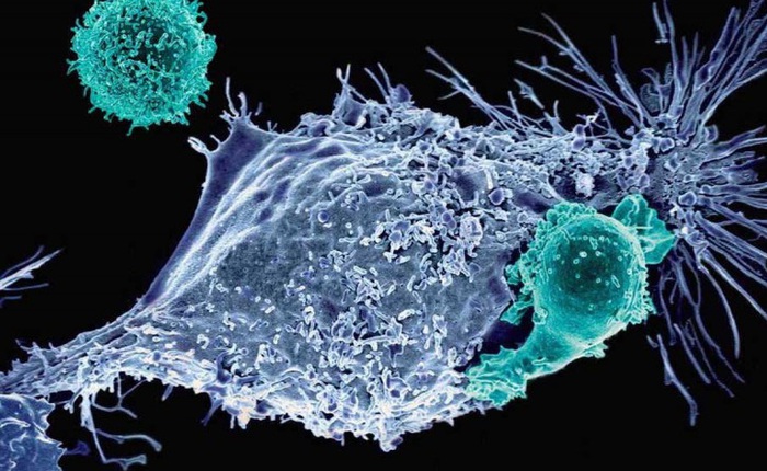 Một bộ công cụ gen biến tế bào thường thành tế bào "cảm tử" lao vào khối u ung thư
