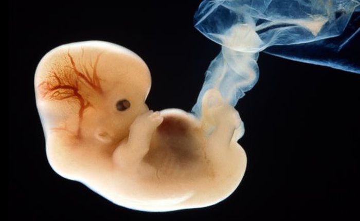 Lần đầu tiên các nhà khoa học Mỹ chỉnh sửa gen thành công trên phôi thai người