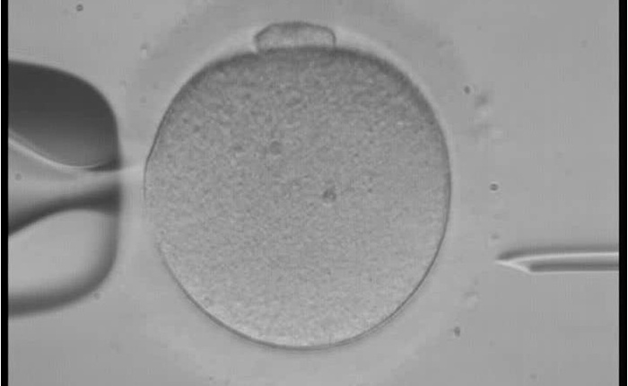 Sự cố thụ tinh trong ống nghiệm: 26 đứa trẻ sinh ra có nguy cơ lẫn lộn cha mẹ