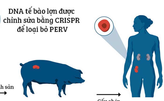 Các nhà khoa học vừa tiến một bước lớn để cấy ghép được nội tạng từ lợn sang người