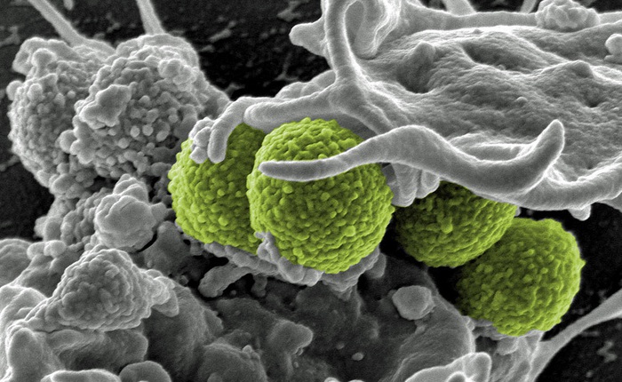 Các nhà khoa học lần đầu phát hiện 76 gen biến vi khuẩn thường thành siêu kháng kháng sinh