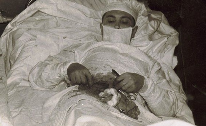 Đây là câu chuyện đằng sau bức ảnh vị bác sĩ người Nga tự phẫu thuật ruột thừa cho chính mình